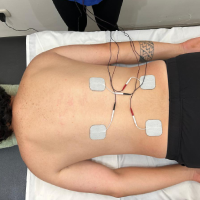 Fisioterapia para el manejo del dolor - Electroterapia