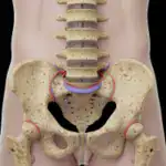Hernia discal: mitos, recuperación real y evidencia científica en fisioterapia